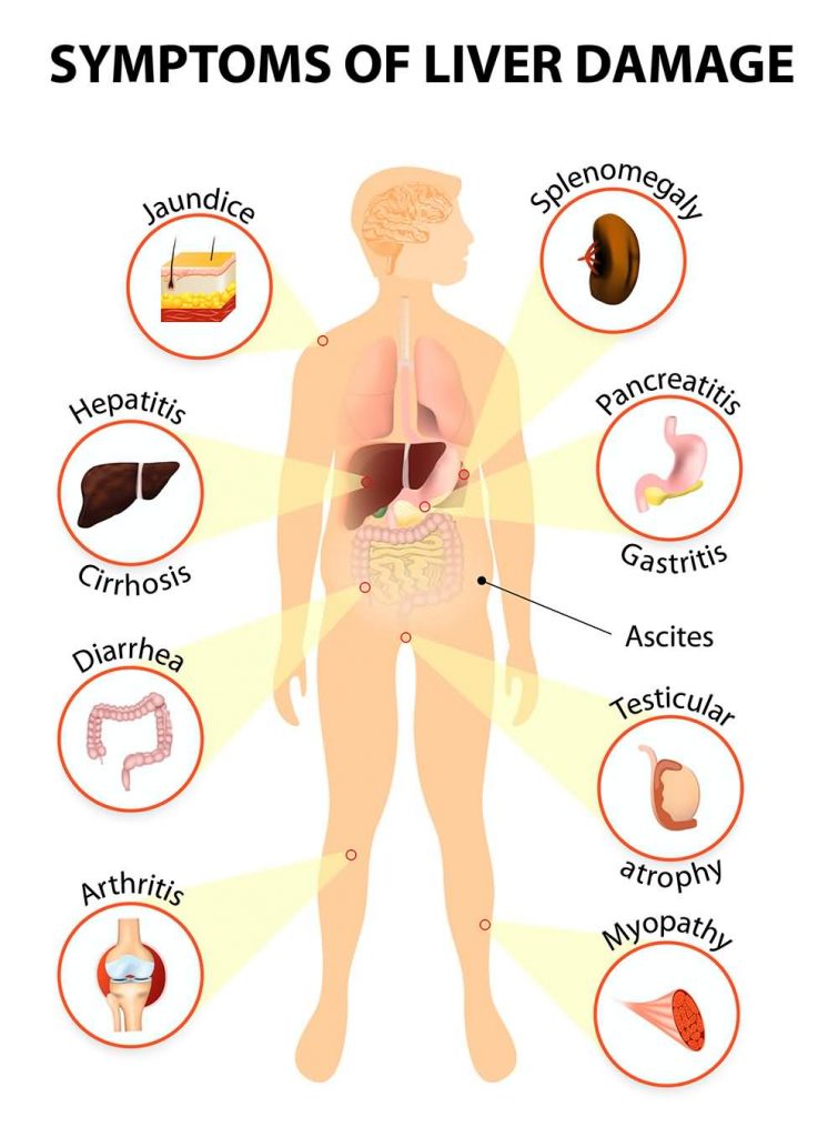 Symptoms of liver damage