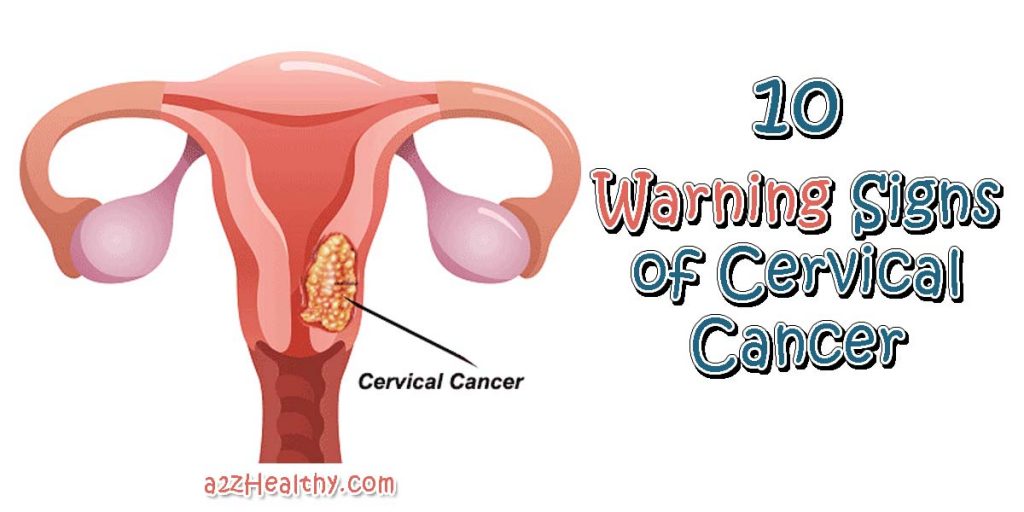 10 Warning Signs of Cervical Cancer