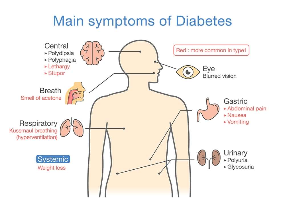 Diabetes symptoms