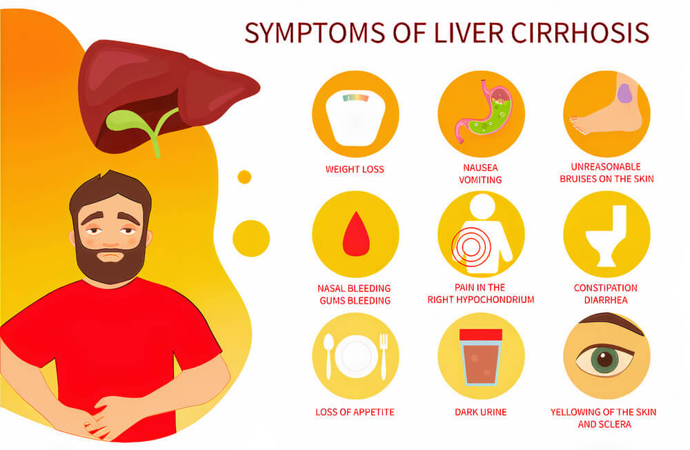 What Are The Symptoms of Cirrhosis? 11 Liver Cirrhosis Symptoms!