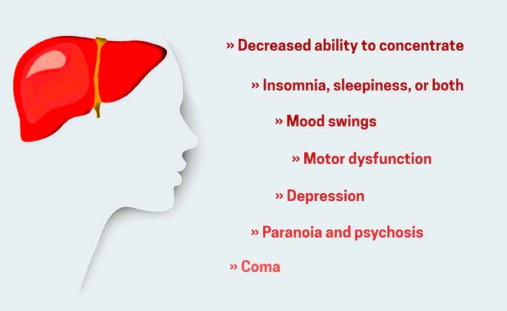 hepatic-encephalopathy-symptoms-stages-treatment-prognosis