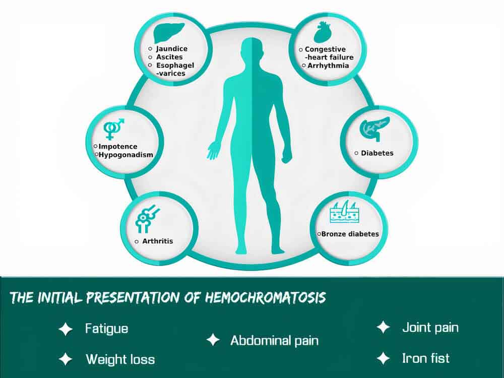 Hemochromatosis (Hereditary Hemochromatosis) | Iron Overload