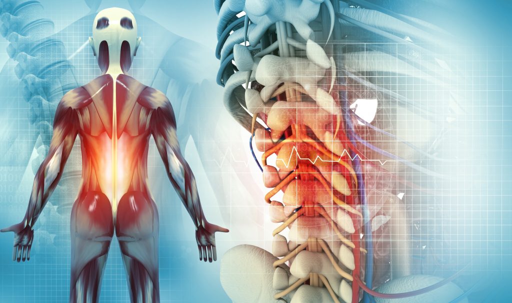 spinal stenosis